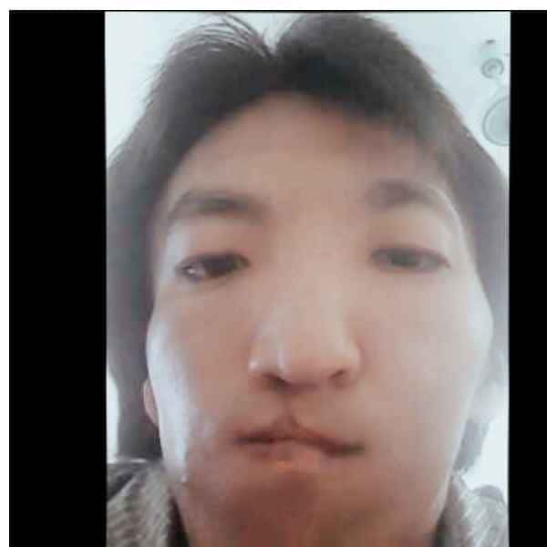 重庆残疾人帅哥真诚相亲找对象，吉缘网