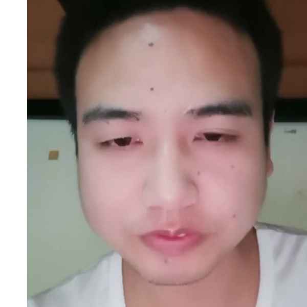 湖北残疾人帅哥真诚相亲找对象，吉缘网